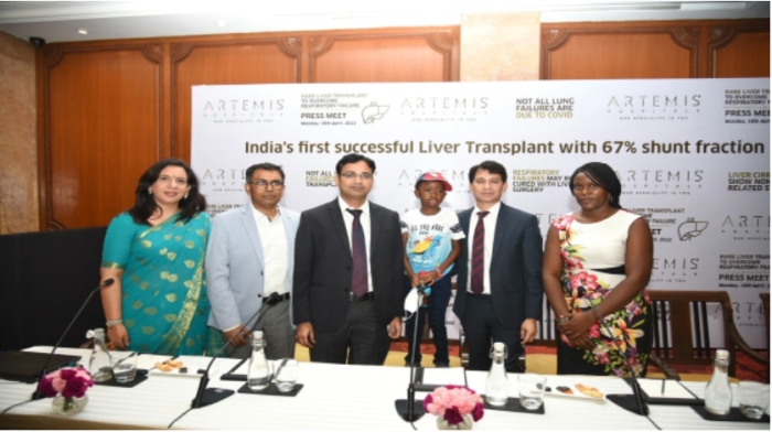 5-year-old-from-zimbabwe-suffering-from-rare-respiratory-failure-successfully-undergo-liver-transplant-at-gurugram-hospital