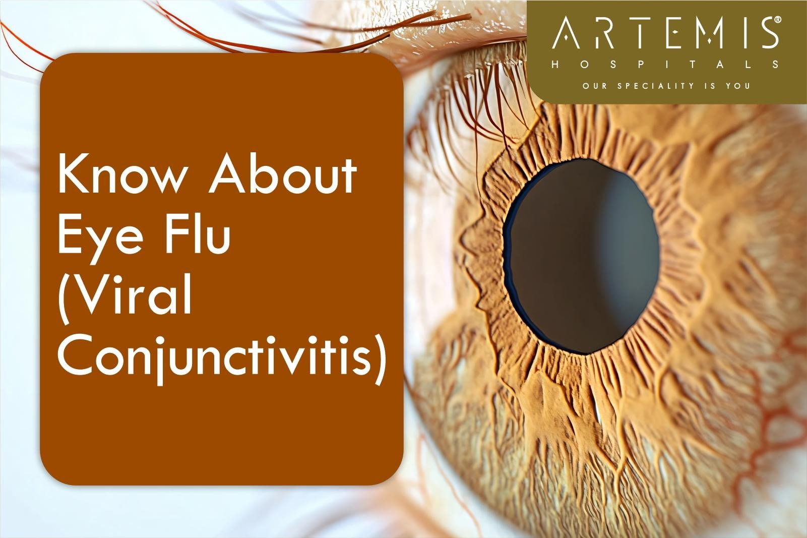 Eye Flu Symptoms?