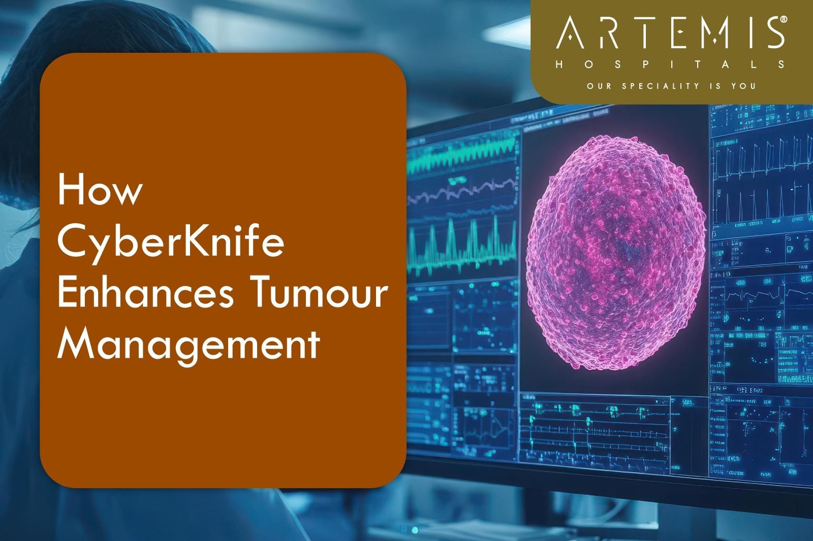 High Precision Radiotherapy