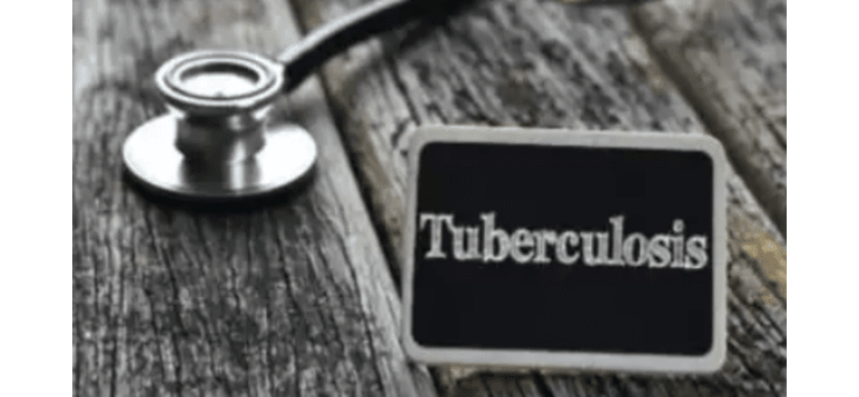 tuberculosis-detection-pilot-project-launched-in-gurugram
