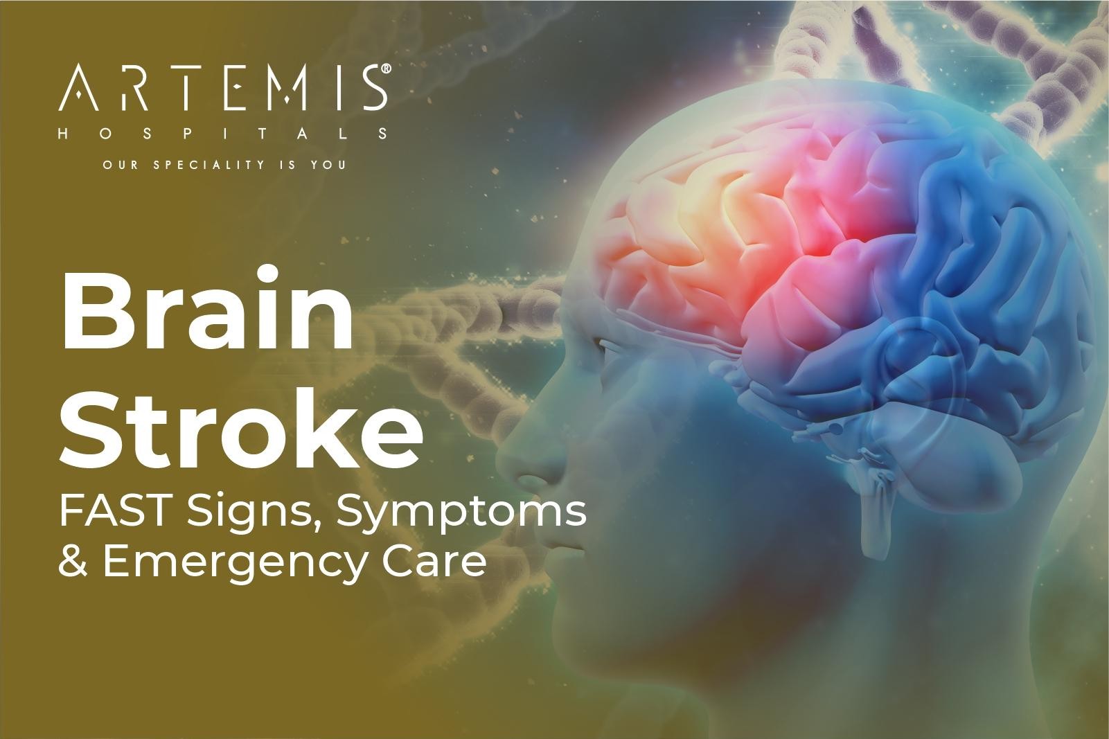 Brain Stroke Symptoms