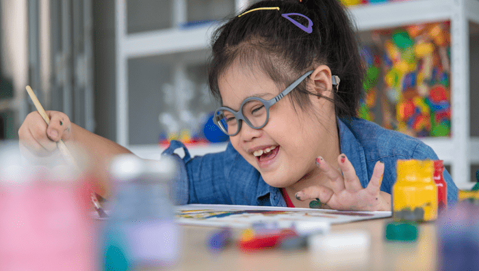 down syndrome symptoms