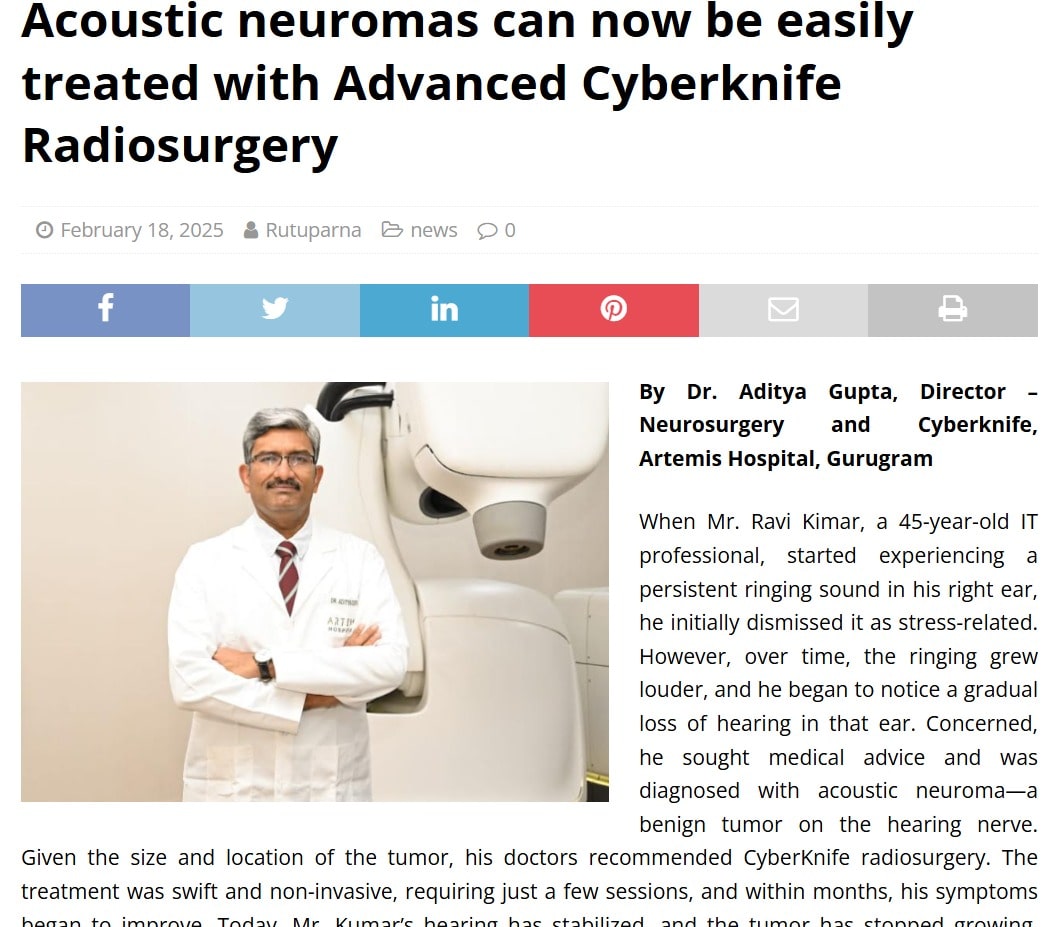 cyberknife-radiosurgery-for-acoustic-neuroma